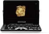 VINNO A3 Portable Ultrasound Machine Kenya: Compact, Powerful, and Portable