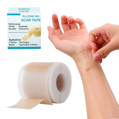 ACTIVE SCAR GEL SHEET Roll