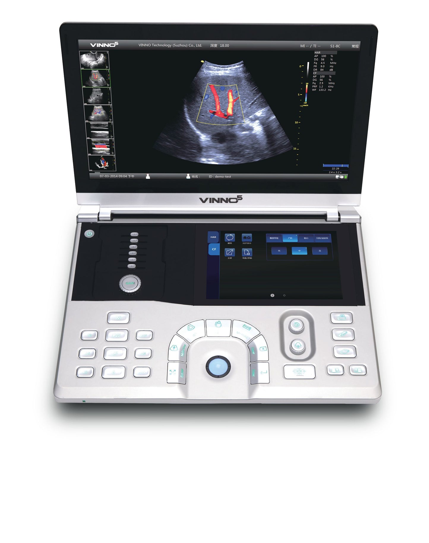 Ultrasound machines Kenya