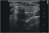 Ultrasound machine| vinno 5 | Portable Diagnostic tool for Kenya