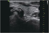 Ultrasound machine| vinno 5 | Portable Diagnostic tool for Kenya