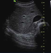 Ultrasound machine| vinno 5 | Portable Diagnostic tool for Kenya