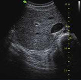 Ultrasound technology Kenya