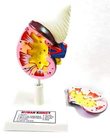 Kidney model