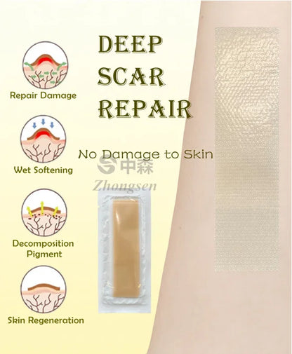 ACTIVE SCAR GEL SHEET Roll