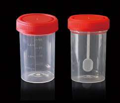 Lab Stool Container with Scoop - Accurate Stool Sample Collection ...